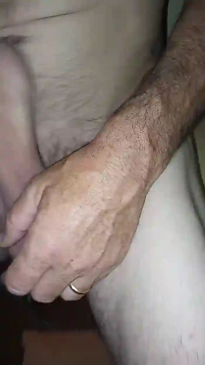 Aple82