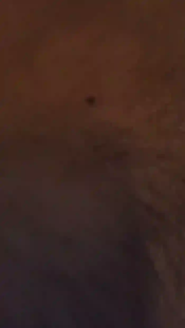 Billyytomy