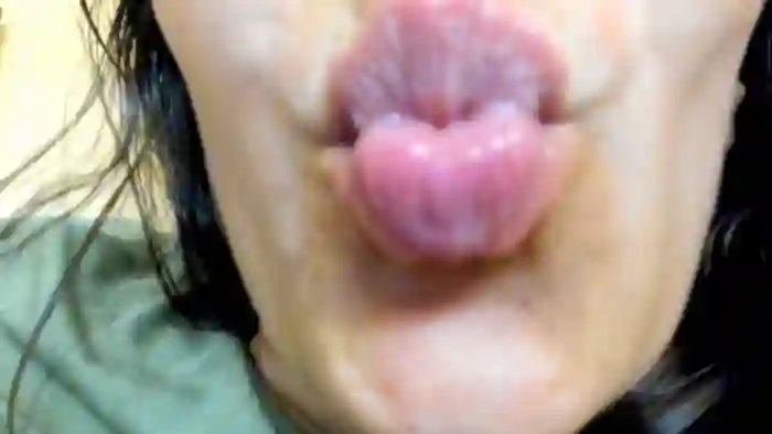 Biatriss