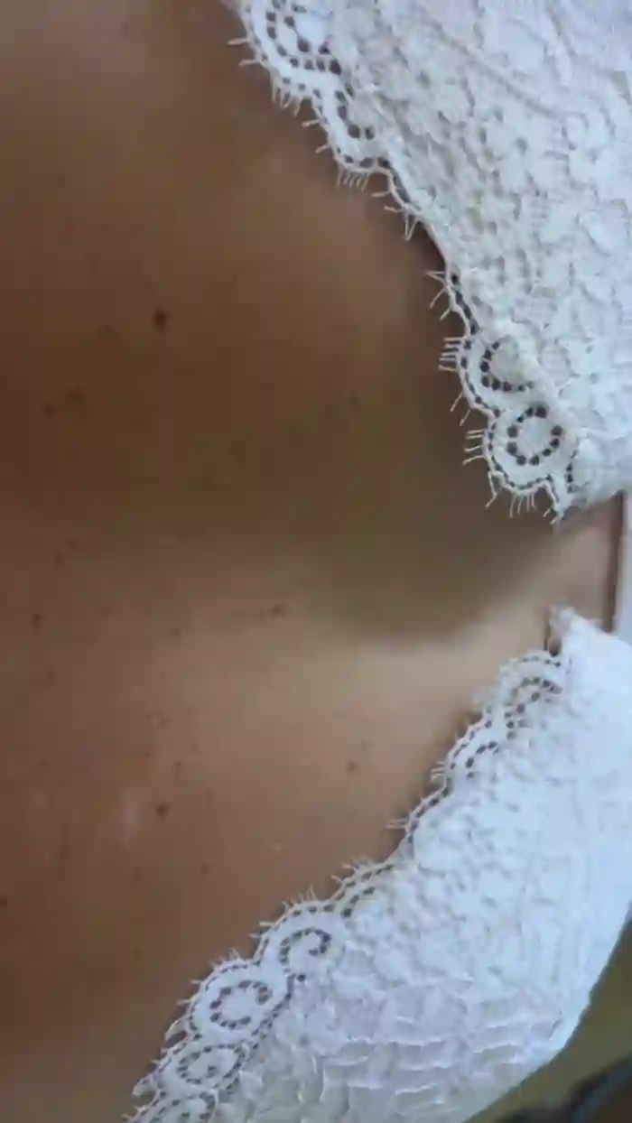 Nonlosolapas