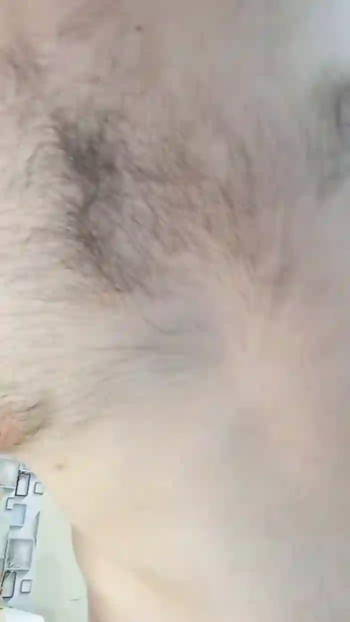 Billyytomy